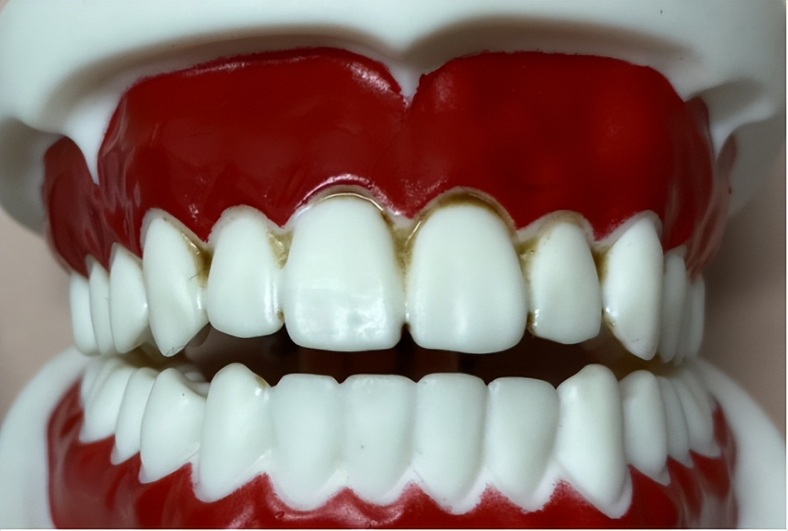 牙刷电动usmile测评2024,电动牙刷测评usmilep1和p2