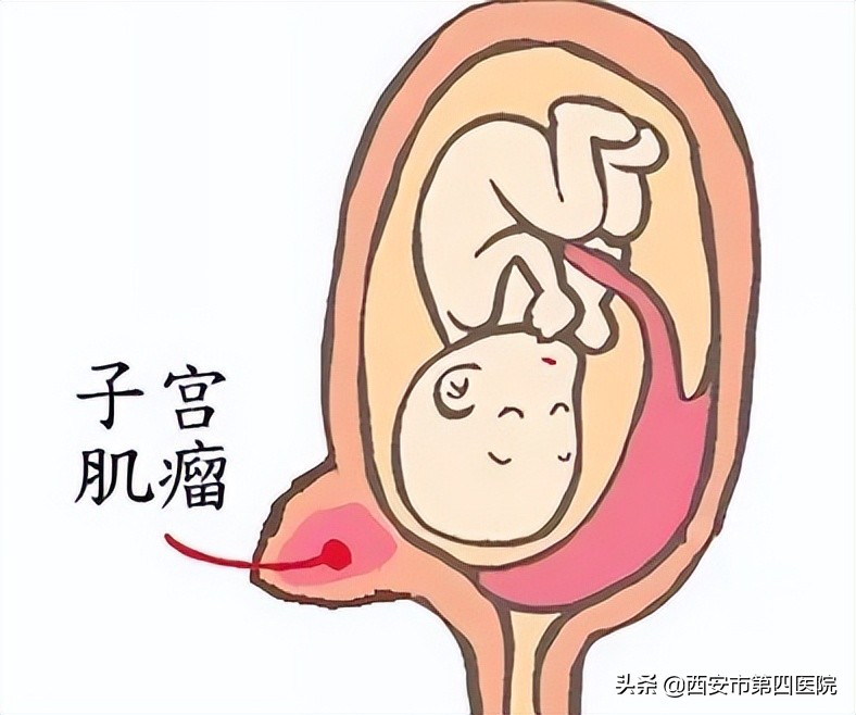 健康中国2023行动,健康中国行动2019-2030主要任务