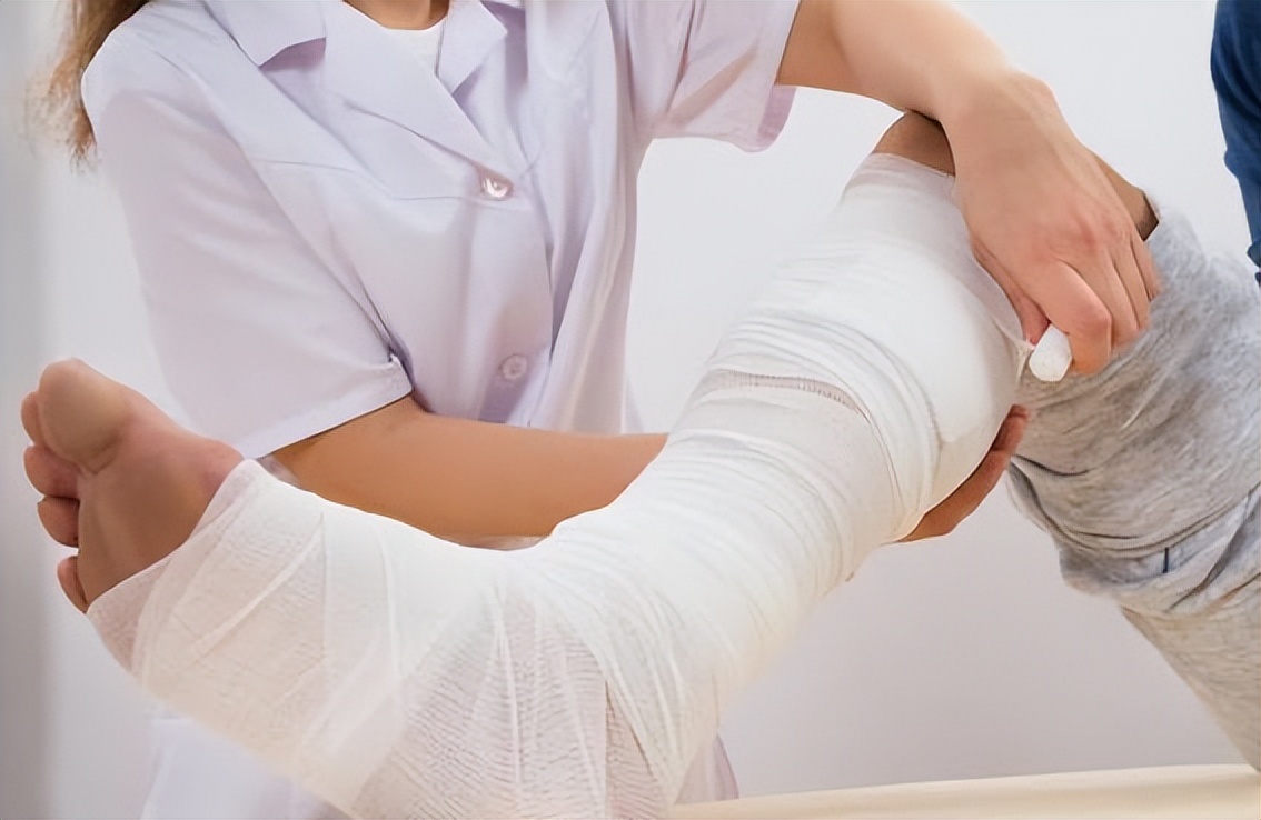 右手桡骨骨折手术后怎样不留疤痕,骨折术后拆线了会留疤吗