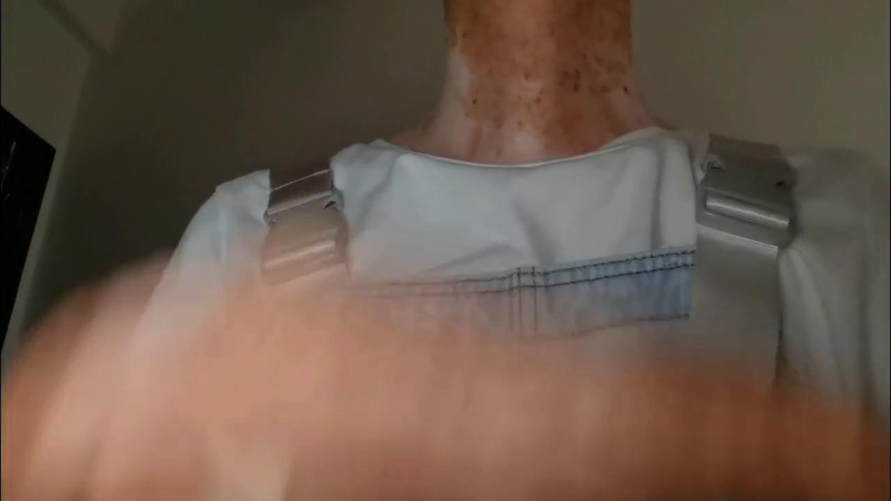 除了接受,还能怎样!!!#着色性干皮症