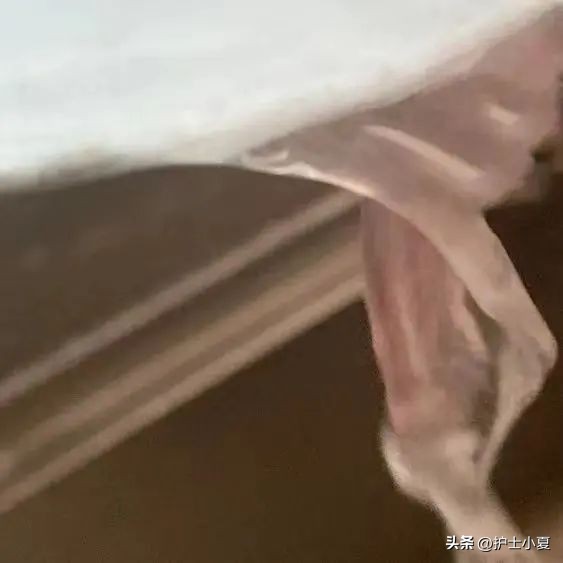 妇科病裤子总是湿湿的,例假过后裤子老是湿湿的