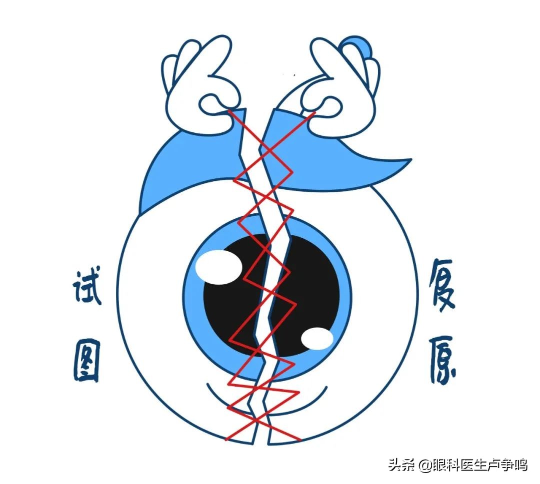 眼底检查怀疑有裂纹,眼底出现裂痕原因