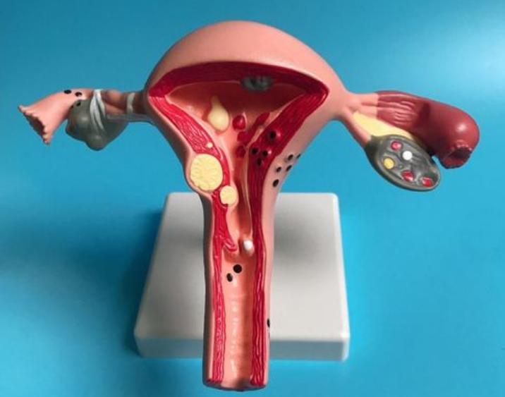 女生体检妇科有什么要注意的吗,做妇科检查前要禁止做什么