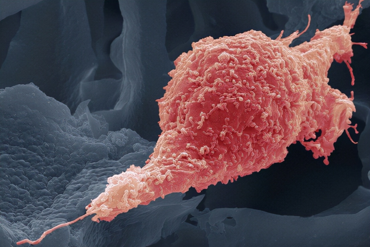 绝经后又来月经与活血药有关吗,绝经后又来月经会不会腰疼