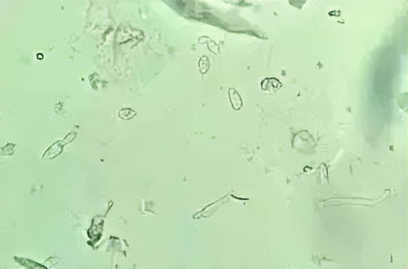 派特灵治妇科病吗,派特灵在妇科怎么使用