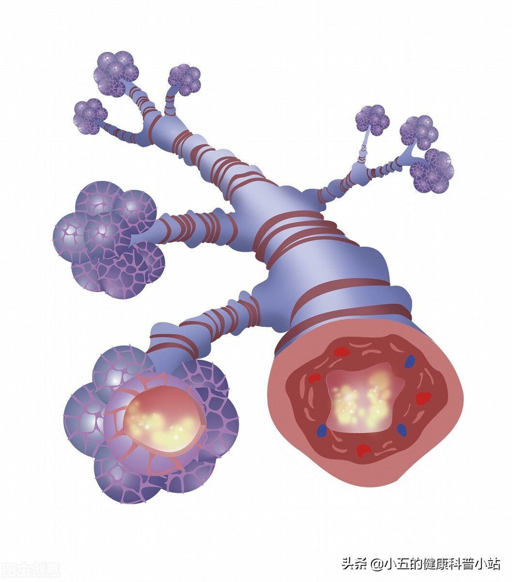 乙酰半胱氨酸治疗慢性支气管炎吗,乙酰半胱氨酸片直接口服