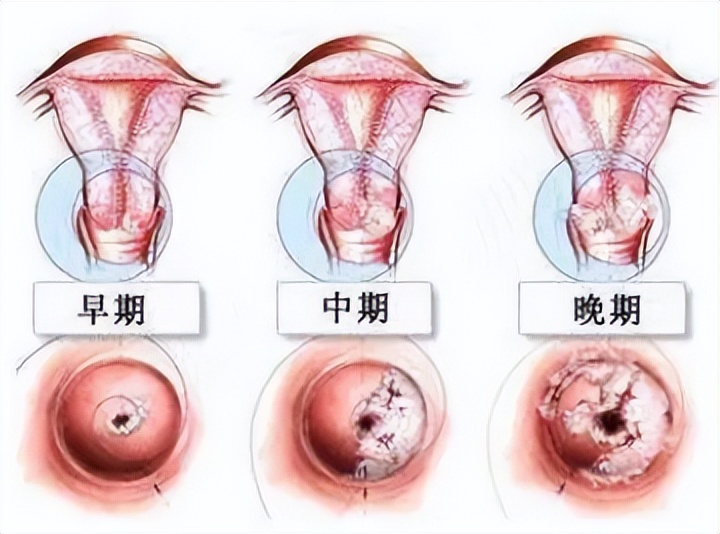 女裤上发黄有异味什么原因,女裤发黄是有妇科病吗