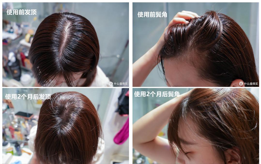 脱发别焦虑，10个细节帮你改善！奉上9款亲测好用的防脱育发产品