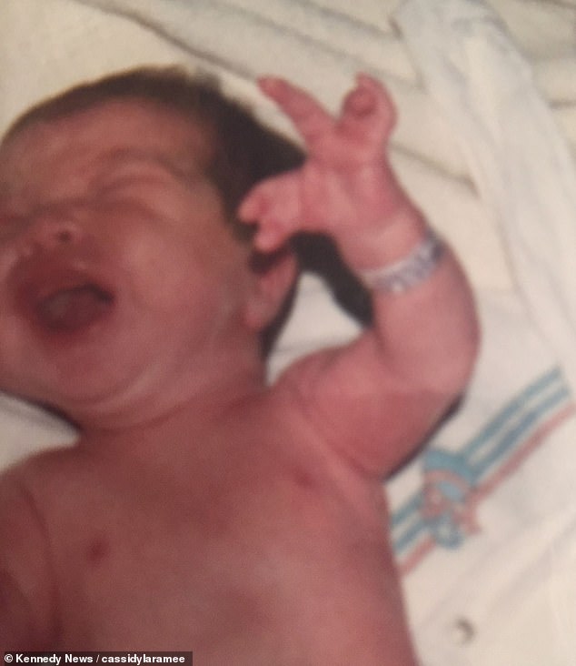 妹子天生只有3根手指，别人说她“霸王龙”，她用乐观狠狠反击！