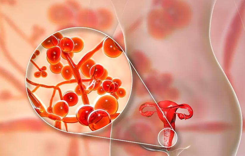 女人的“尴尬部位”老是瘙痒?医生：这4个原因，最好一个个弄清