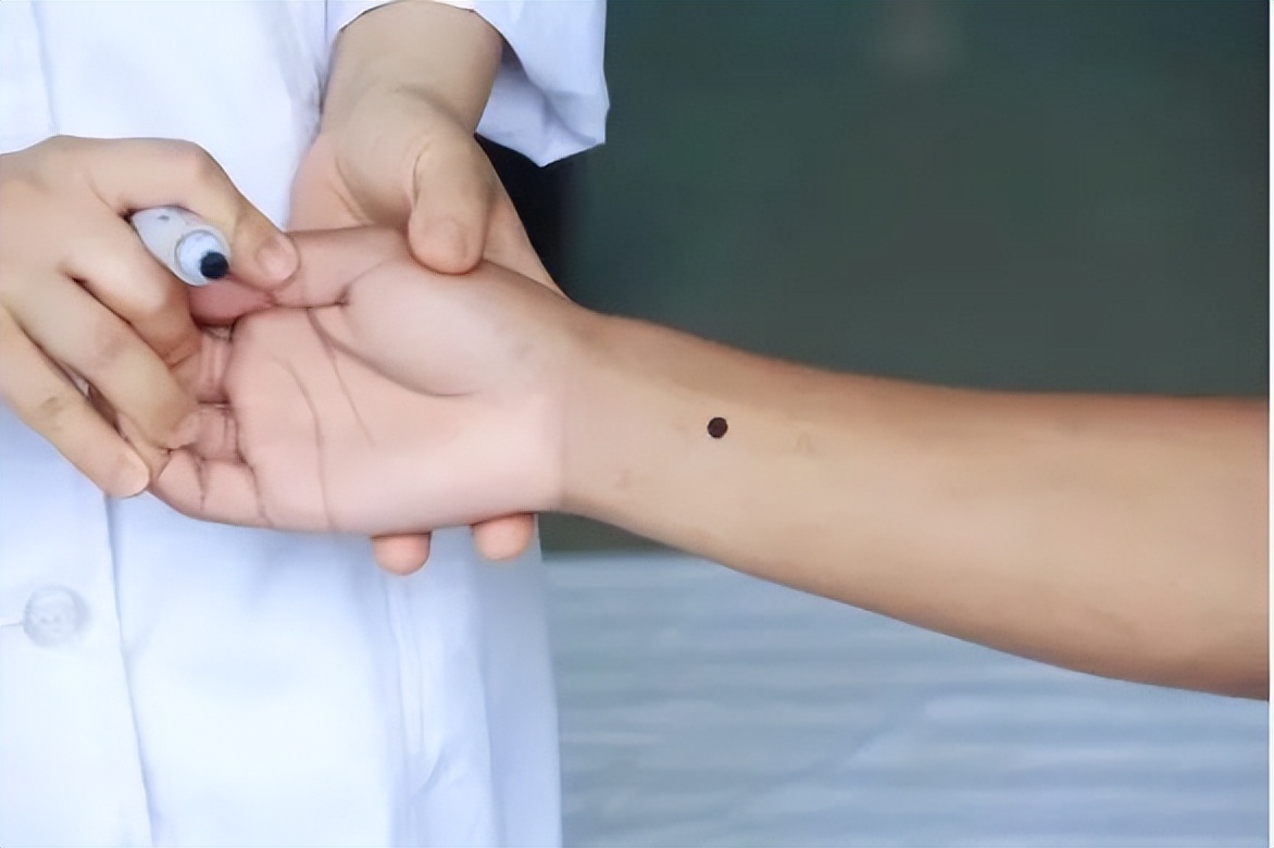 鼠标手手腕疼缓解方法,手握鼠标手麻了怎么办