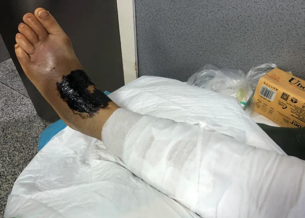 头皮发麻！山东女子从洗衣机洗出冻僵蛇，雄黄驱蛇是“摆设”吗？