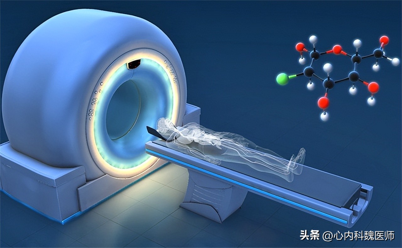 钇90微球疗法肝癌效果,钇90树脂微球治疗肝癌手术费用