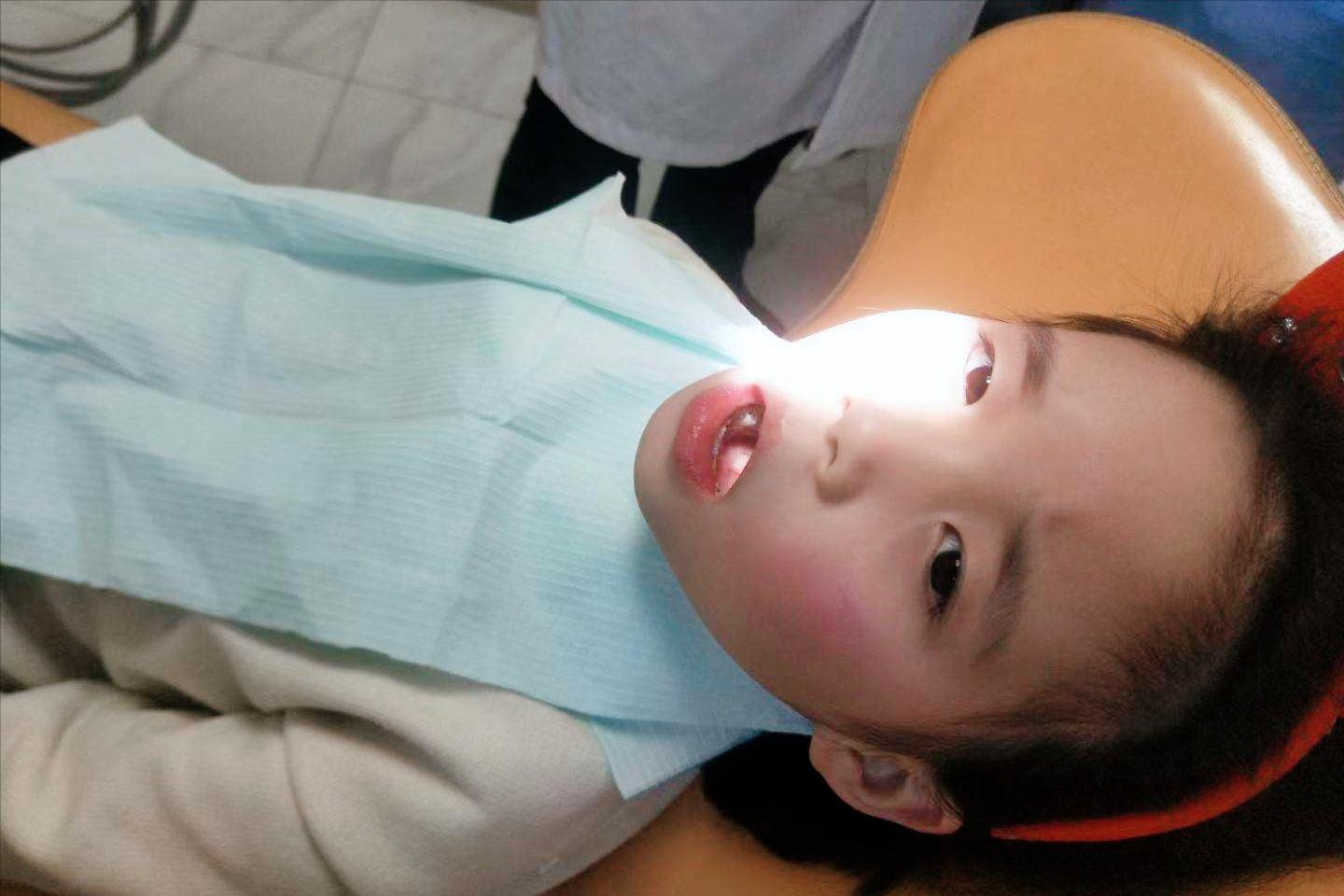 孩子有双排牙,小孩长双排牙前面的乳牙很松没掉