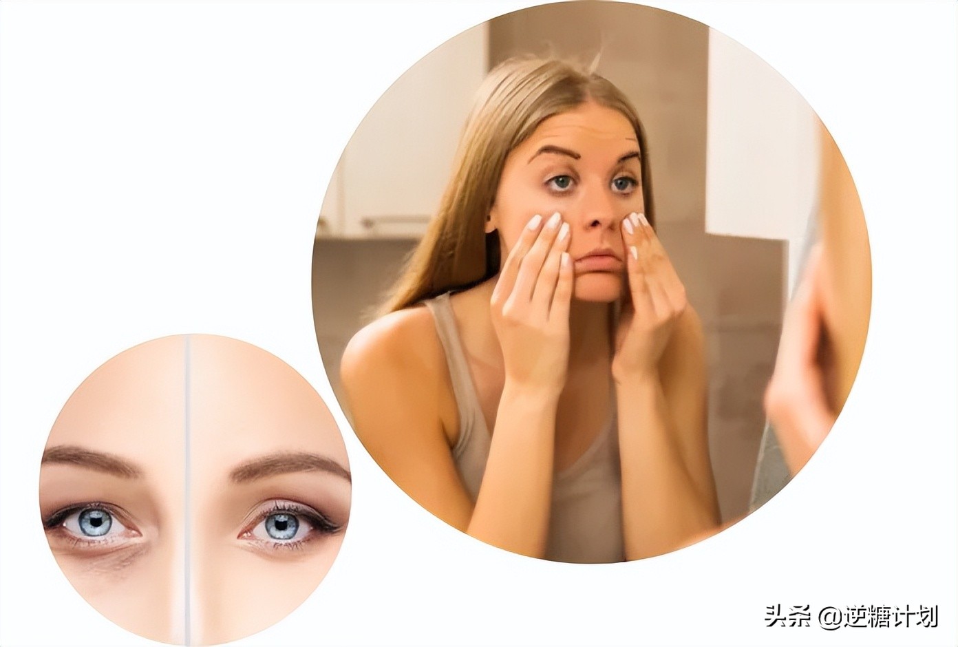 眼皮浮肿怎么办快速消除,眼皮浮肿怎么办最快最有效