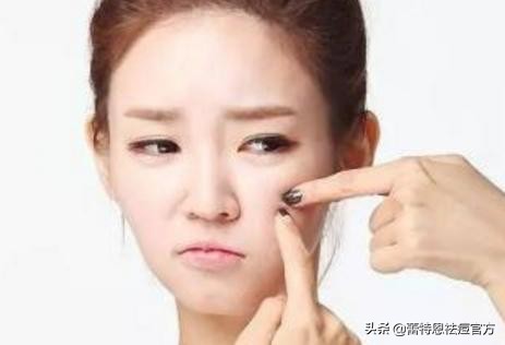 蕾特恩淡化痘印是什么产品,蕾特恩祛痘后痘印怎么越来越多了