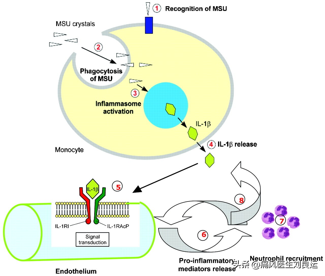 痛风发作吃依托考昔片秋水仙碱,痛风依托考昔片和秋水仙碱哪个好