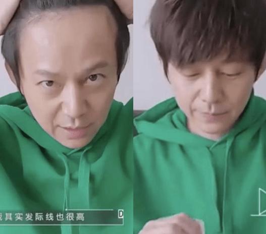 明星逃不过的脱发,明星也秃头还戴假发片