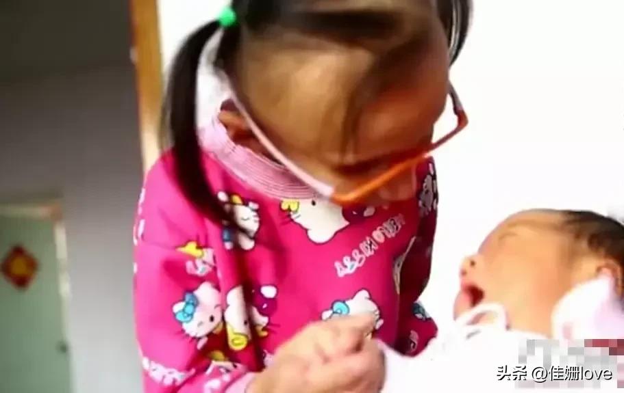 14岁女孩拥有80多岁的容貌，生命的尽头是希望妈妈生个弟弟