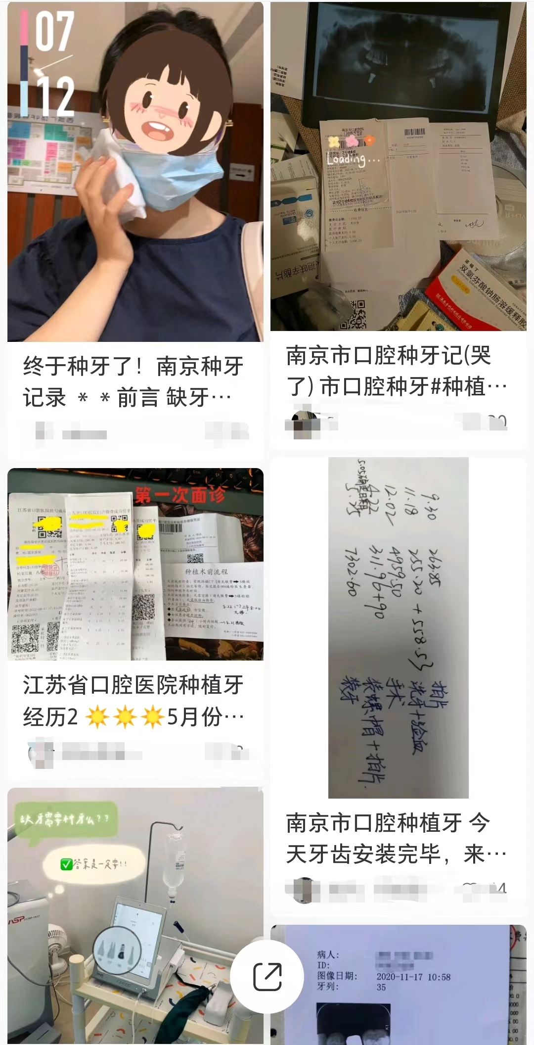 一线城市种植牙比三四城市贵,江苏哪个城市种植牙便宜