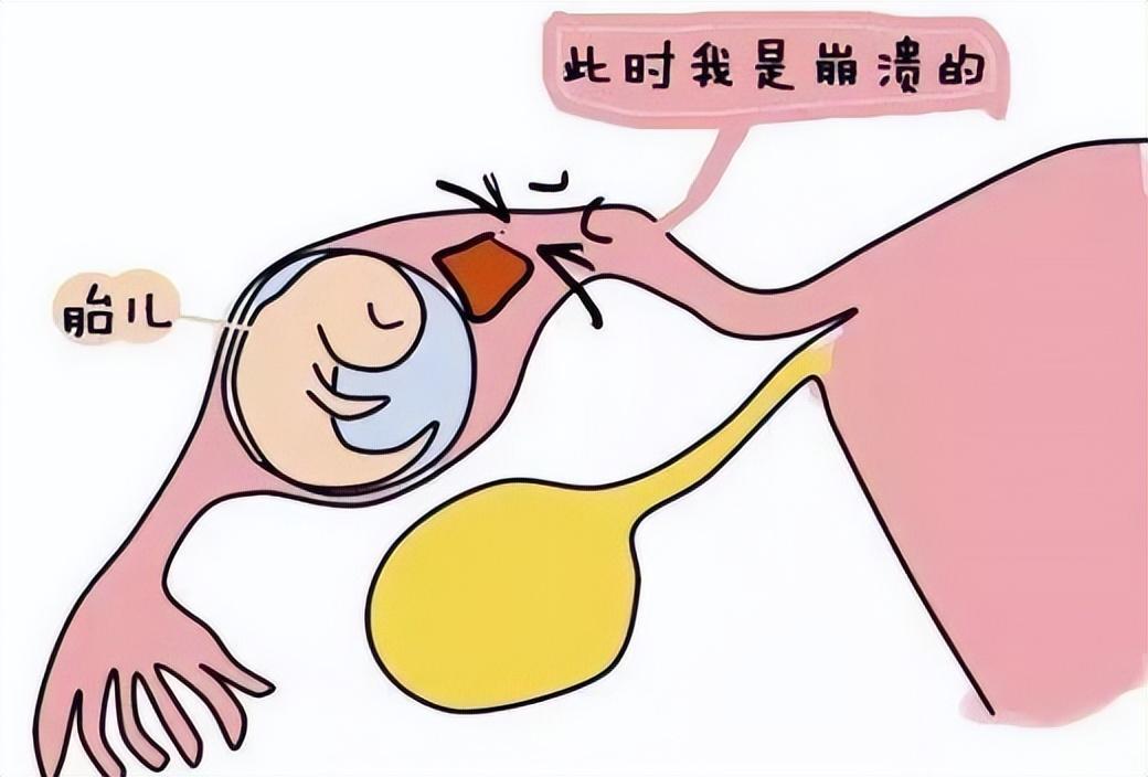 月经结束后一周褐色鼻涕状分泌物,月经后总是有褐色分泌物怎么回事