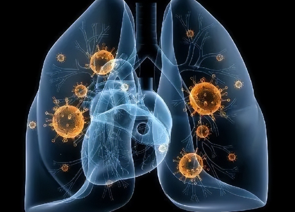 畏寒发热咳浓痰治疗方法,畏寒黄痰咳嗽