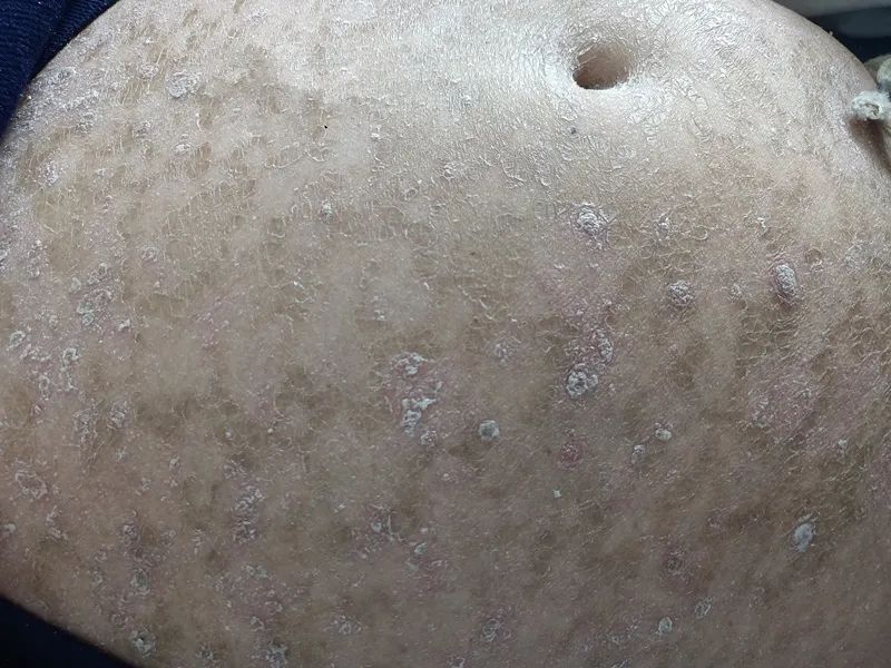 百病从肝治的出处,百病从肝治的中医