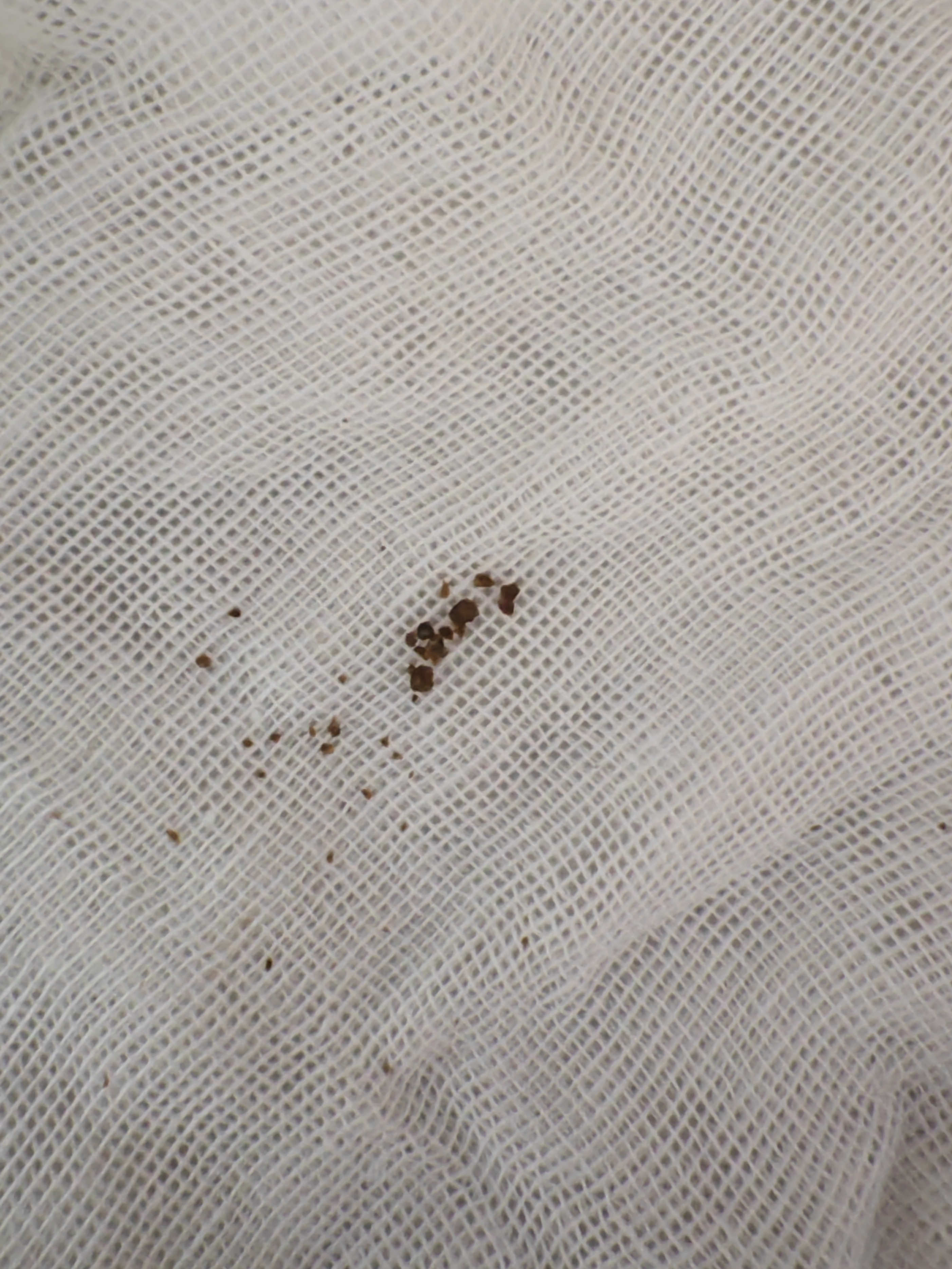 肾结石克星,肾结石最怕三种运动