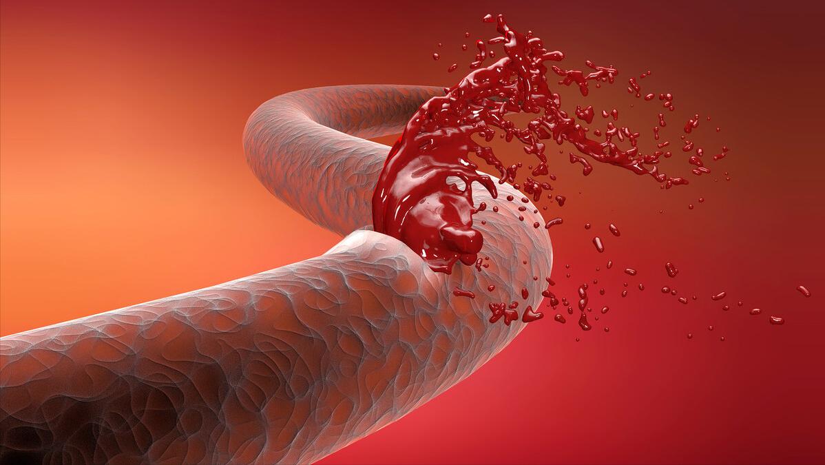 女性一直出血是什么原因引起的,女性出血是什么原因导致的