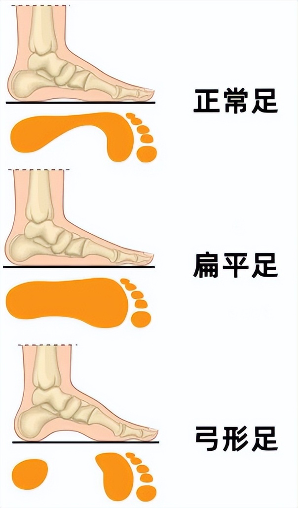 身体好不好看哪些标准,身体好不好看脚就能知道