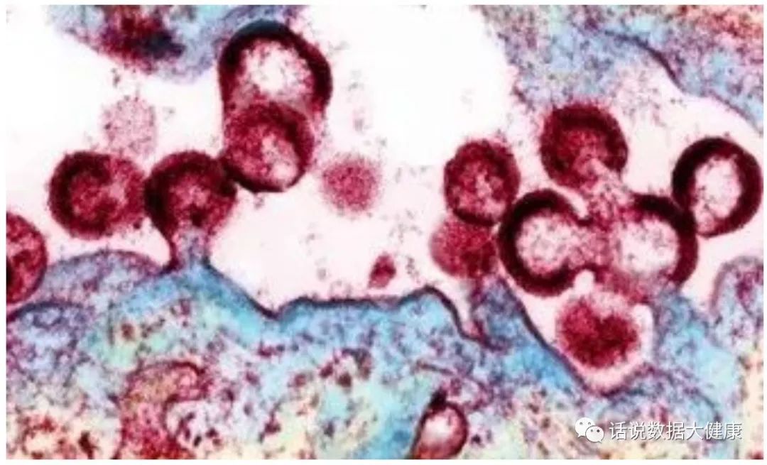 丙肝病毒感染可以治愈，艾滋病治愈还远吗？