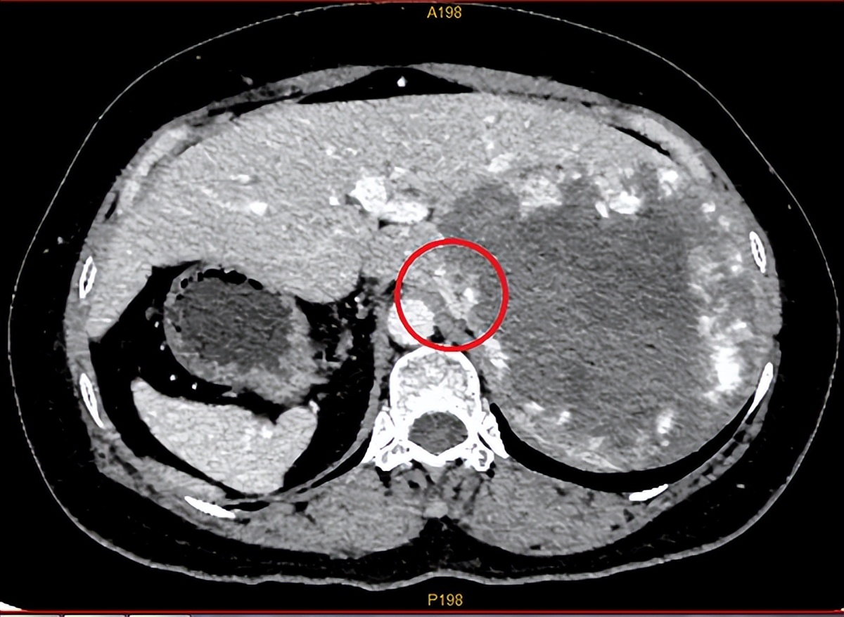 一女子查出五脏六腑,女子发现五脏六腑全长反