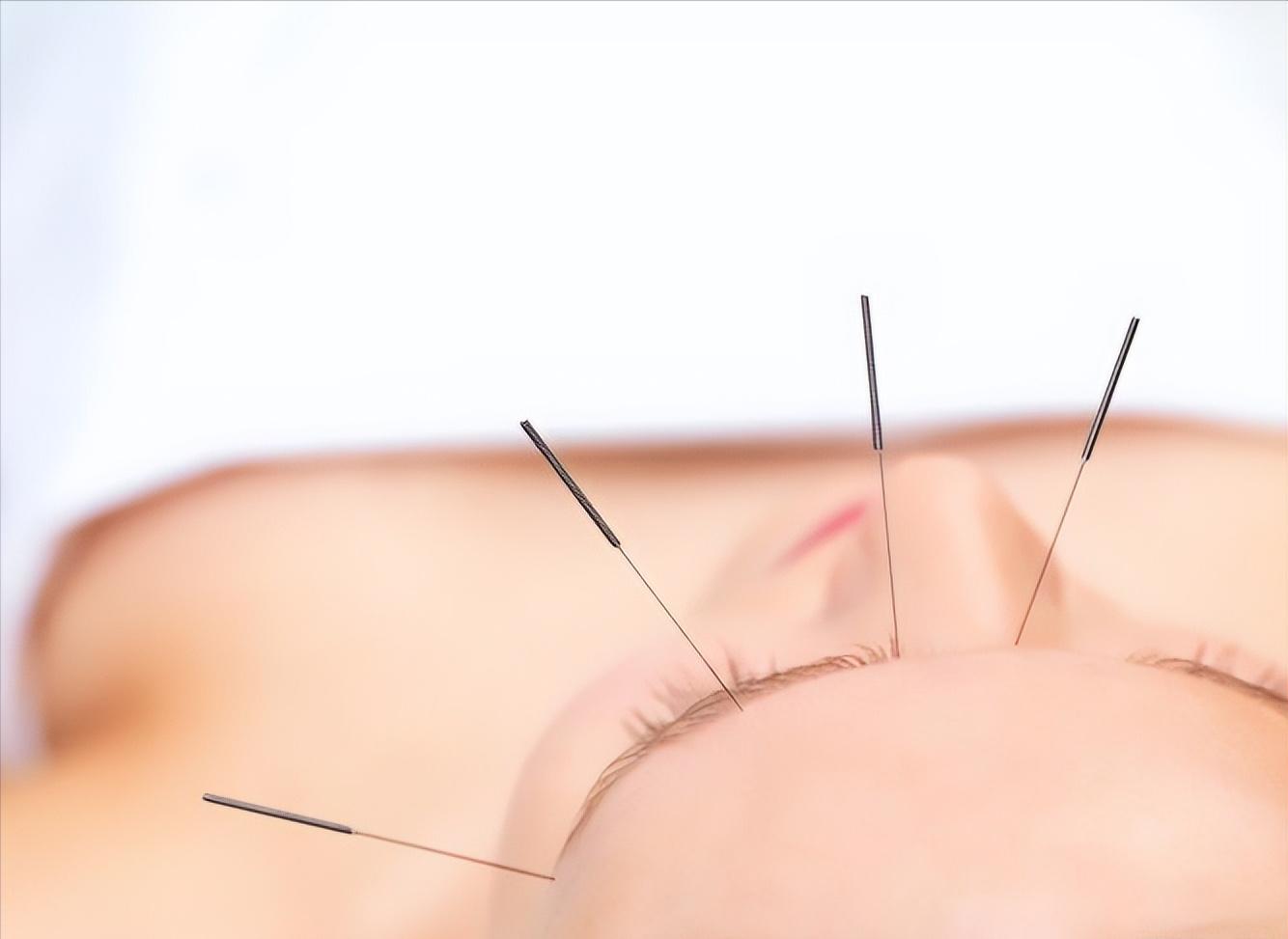 中医针灸治疗腰痛病的学术思想,古法针灸临床治验