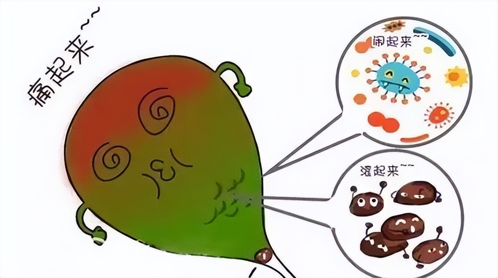 胆结石专家指南,胆结石最怕的克星