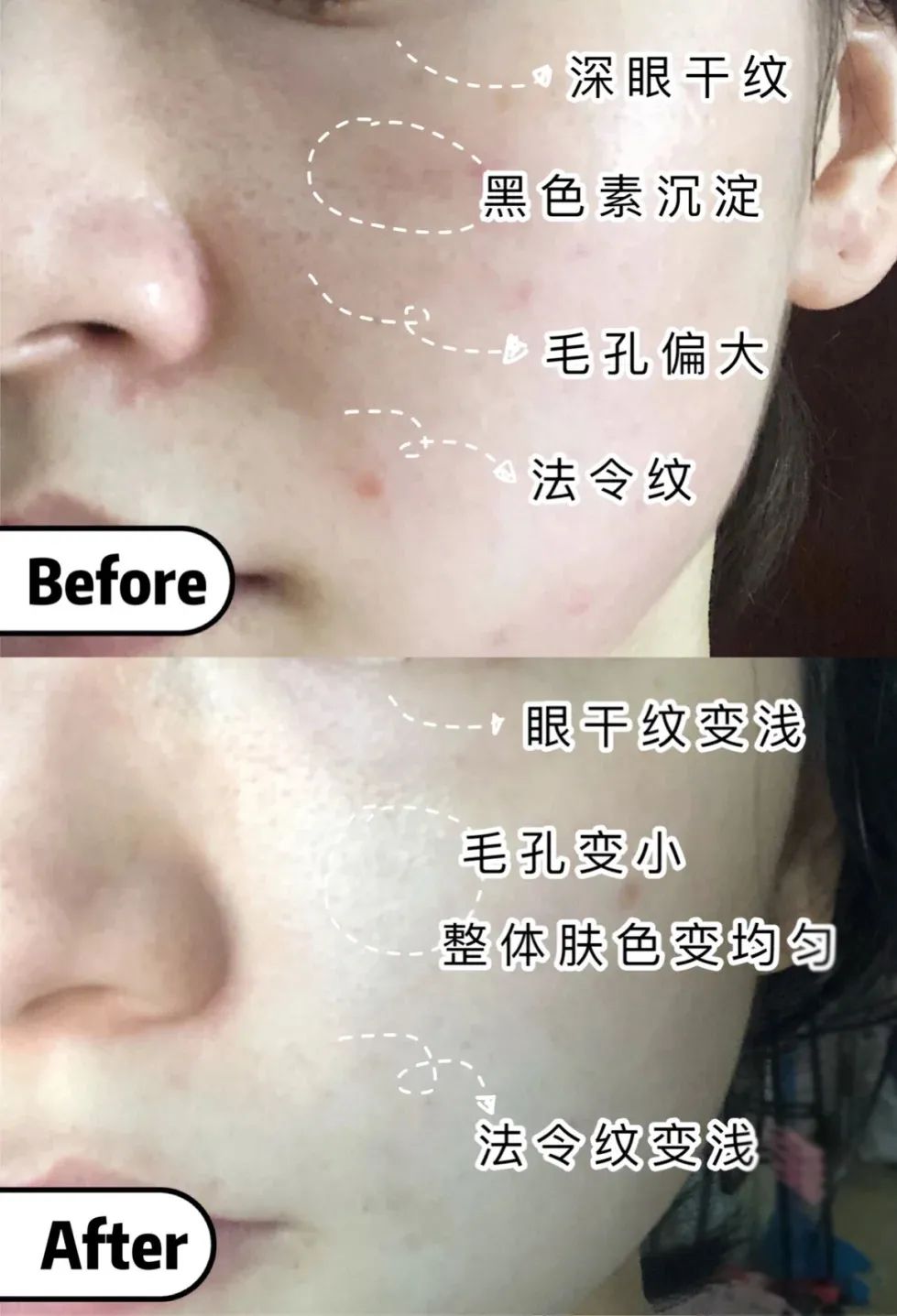 欧莱雅复颜抗皱水乳套装短视频,欧莱雅抗皱紧致水乳套装女