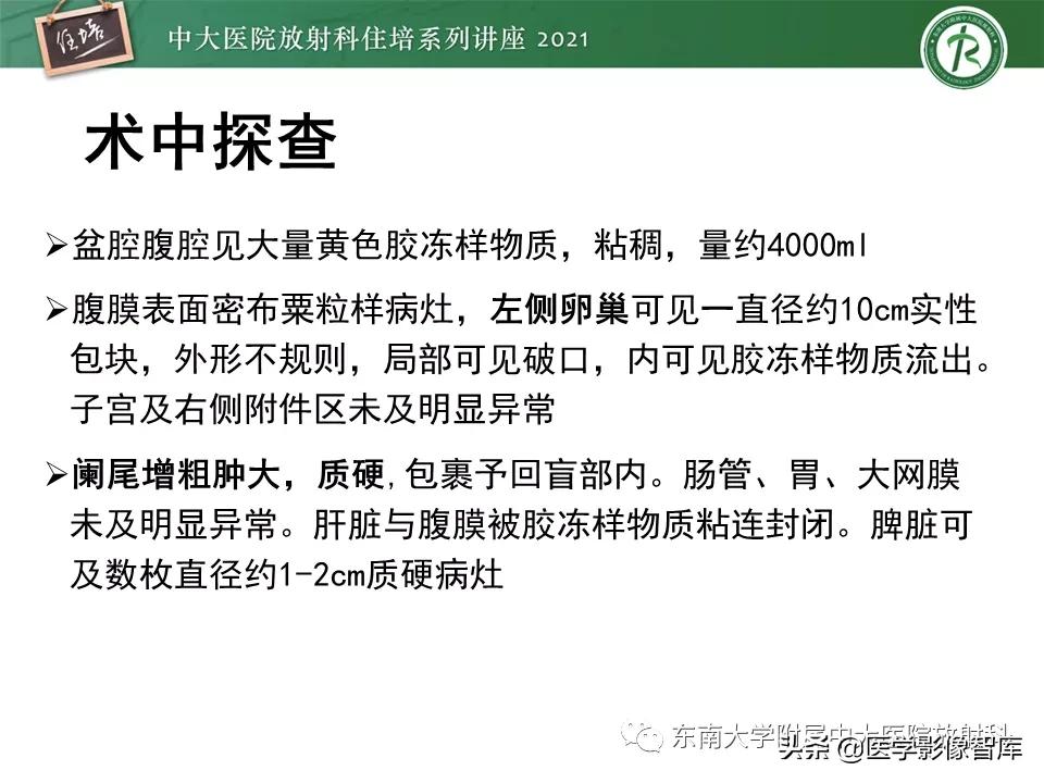 卵巢浆液性肿瘤的肉眼及镜下特征,卵巢原发性粘液性囊腺瘤