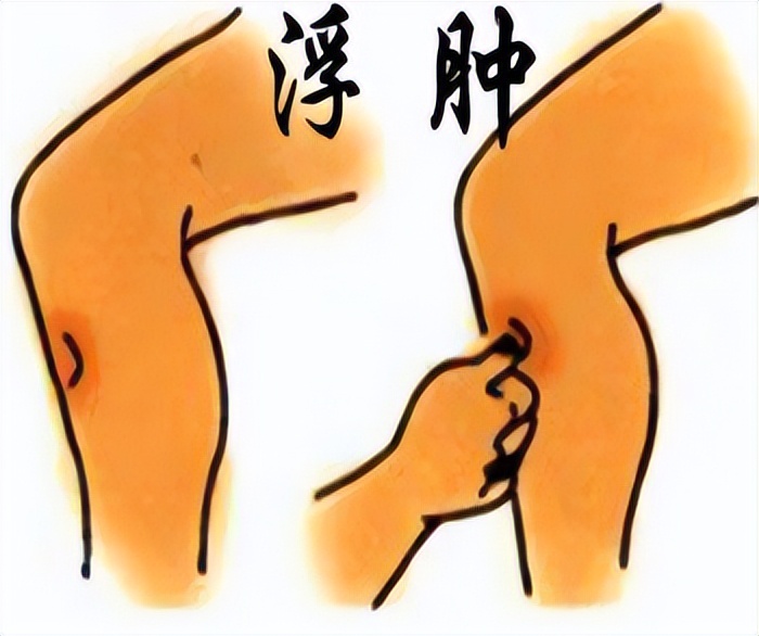 消水肿食疗汤,消水肿常用药