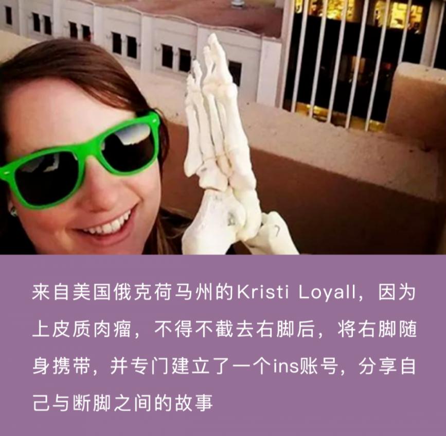 医院截肢最新消息,截肢掉的部位都去哪了