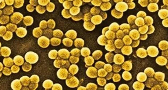 后背长毛囊炎怎么解决,后背长毛囊炎怎么彻底根治