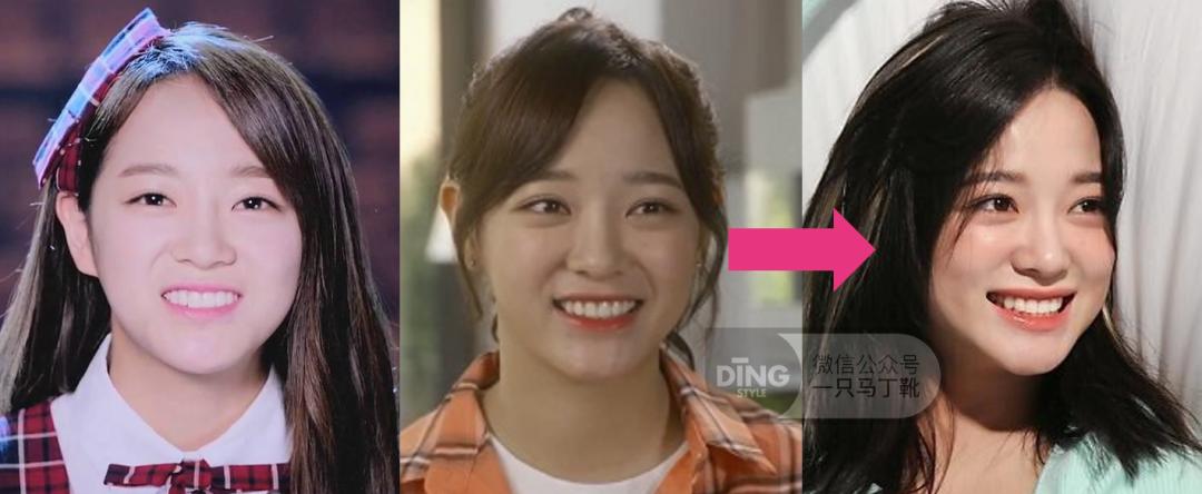 长得很“疲惫”是什么体验?如何改善一脸疲惫相