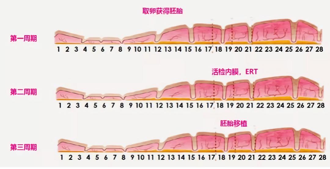 子宫内膜容受性检测正常值,子宫内膜容受性检测是指什么