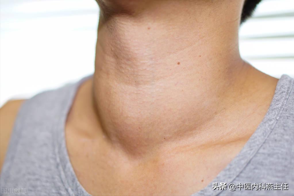 桥本甲状腺炎甲亢结节有什么药,甲状腺炎甲状腺结节甲亢咋治疗