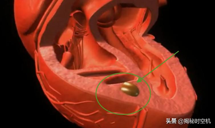 中国孤例！*弹子**击中心脏14年没死？湖南男子奇迹生还至今成谜