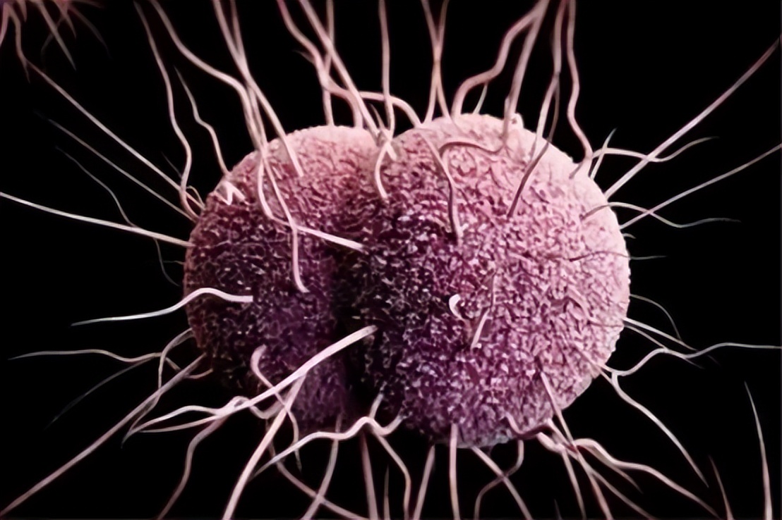 常见的性传播疾病有哪些如何预防,通过性传播的疾病哪个最严重