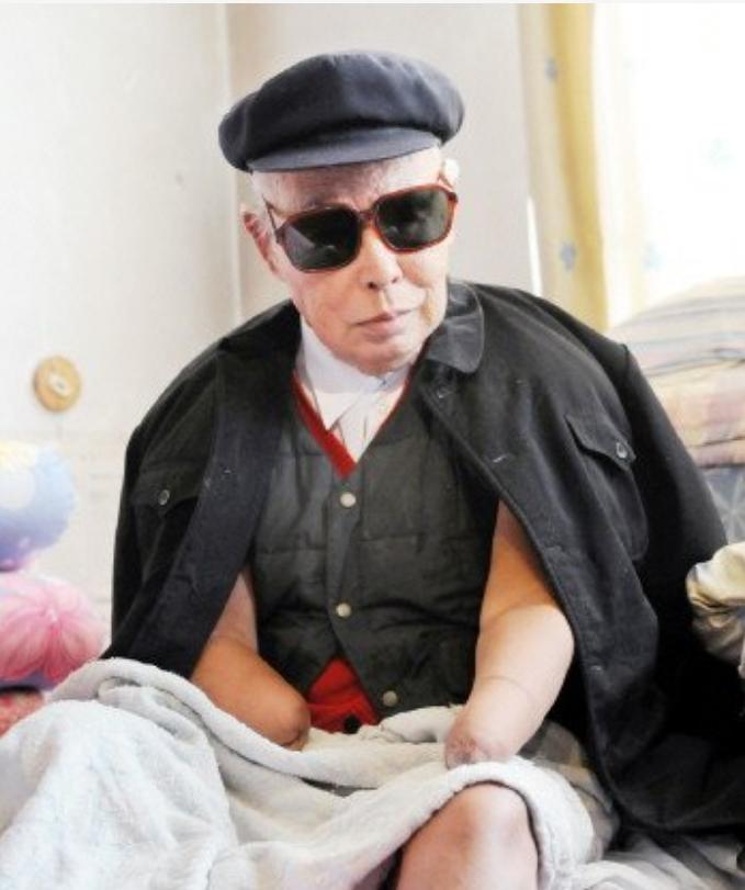 长津湖战役幸存者“朱彦夫”：失去四肢和左眼，今89岁感动中国