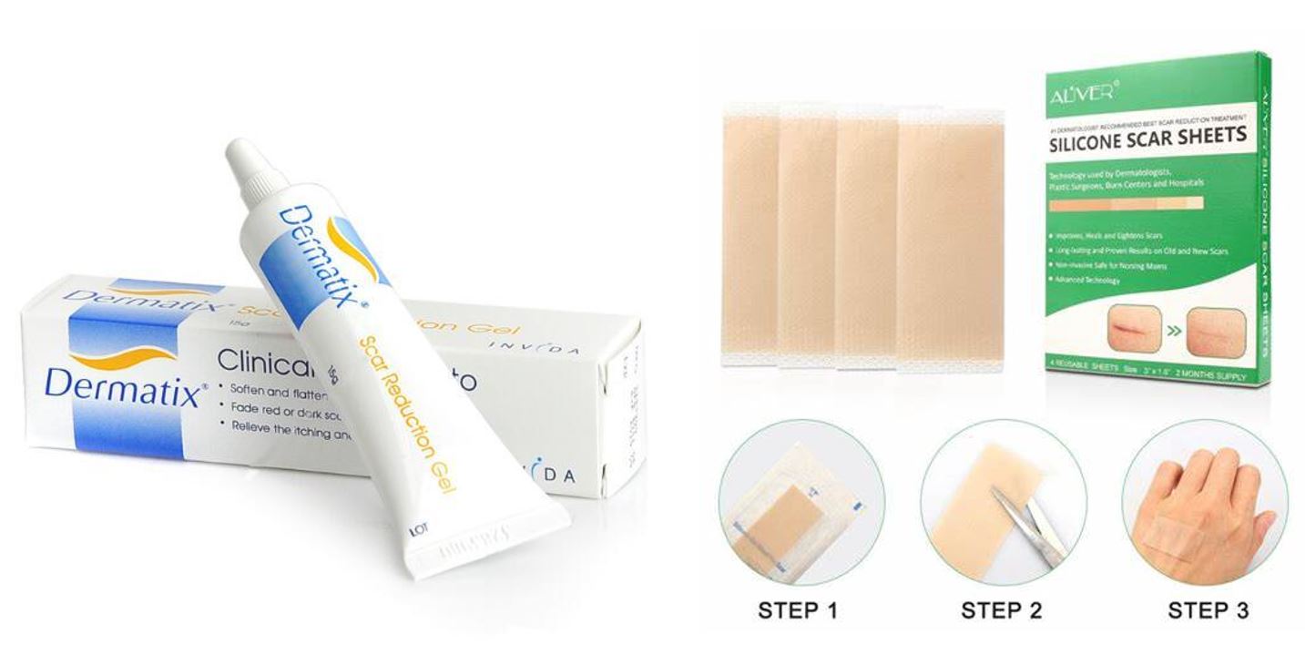 擦伤皮肤疤痕怎么能彻底消除,皮肤擦伤常见处理方法