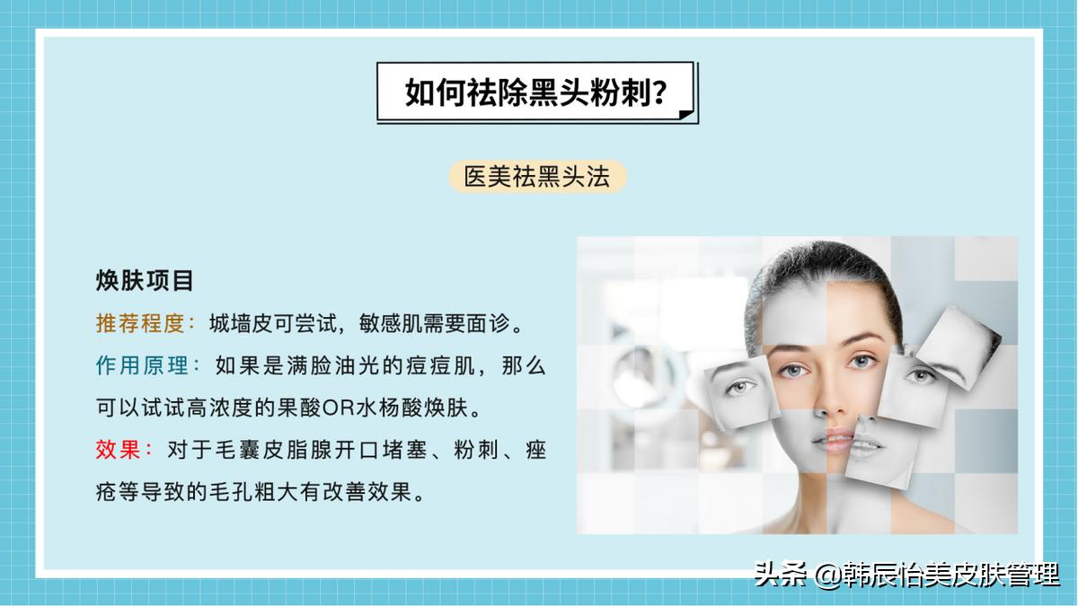 去黑头小妙招最简单的,最有效的去黑头小窍门方法