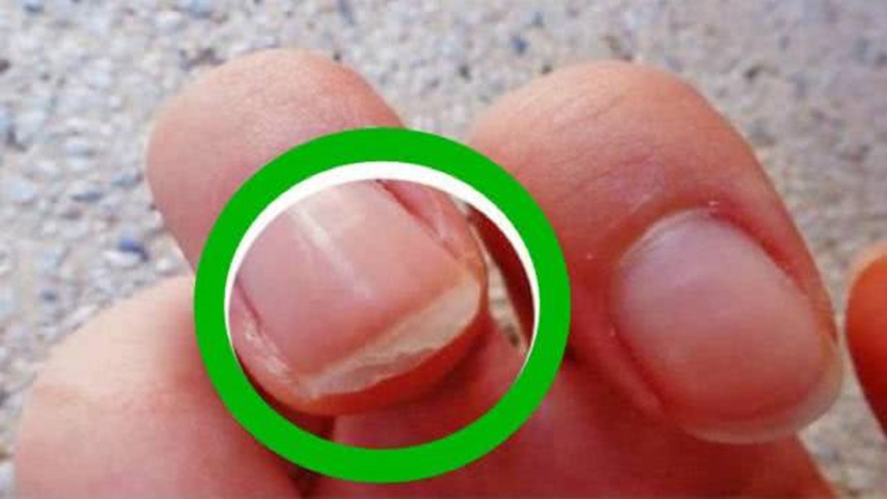 缺乏维生素b2时身体有什么表现,为什么会造成维生素b2的缺乏