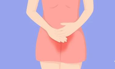 令人困扰的阴道炎，到底拿你怎么办？