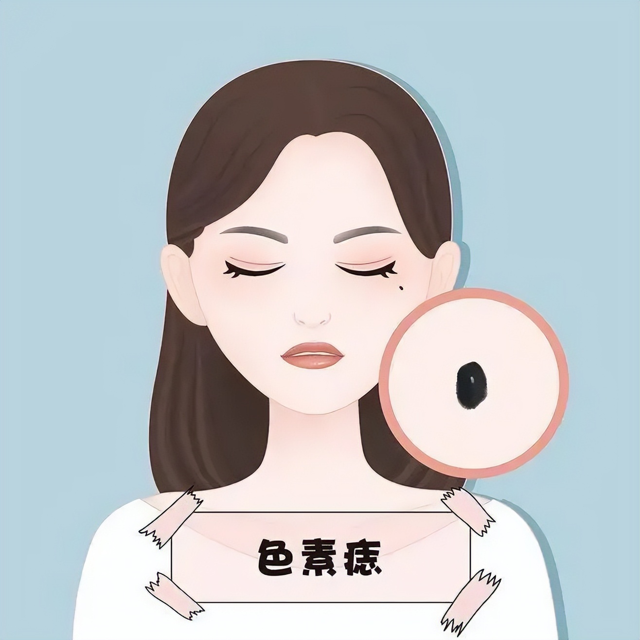 你是否众“痣”成城？跟我一起专心致“痣”